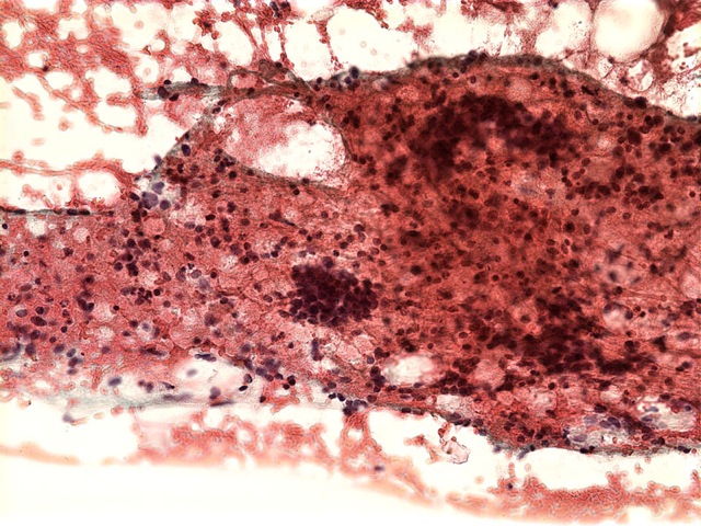 Loading Image